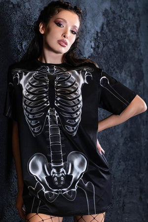 X-Ray Negative Skeleton Tee Dress Close View